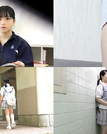 j002 ｜Yちゃん（仮名）｜ちび故障